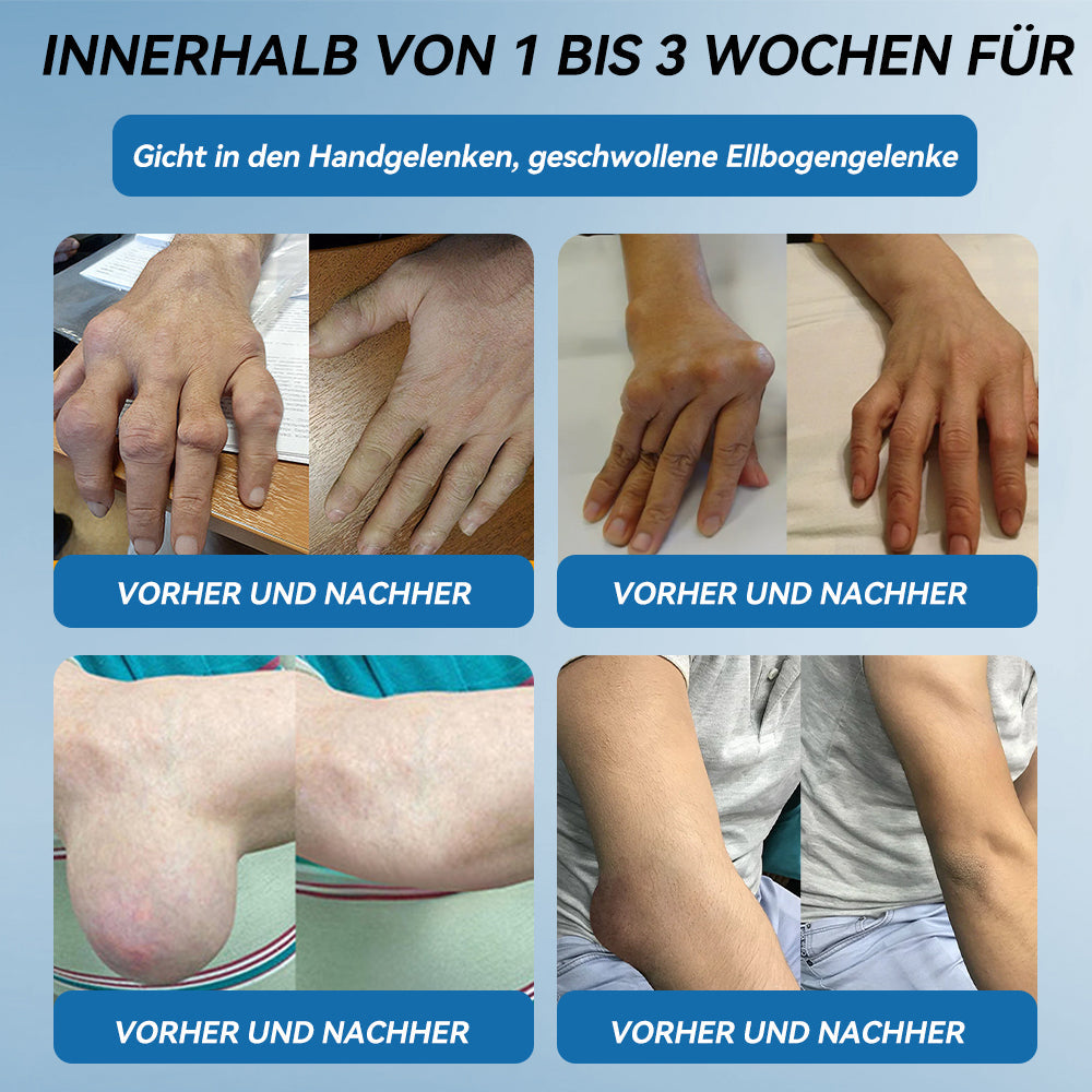 𝖯𝗂𝖼𝗱𝗼® 🍀 BPC-157 Gelenkheilcreme Behandelt Arthritis, Neuropathie, Rheuma, Sportverletzungen & mehr👨🔬