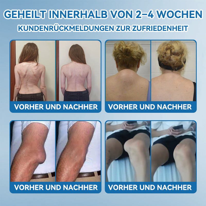 𝖯𝗂𝖼𝗱𝗼® 🍀 BPC-157 Gelenkheilcreme Behandelt Arthritis, Neuropathie, Rheuma, Sportverletzungen & mehr👨‍🔬