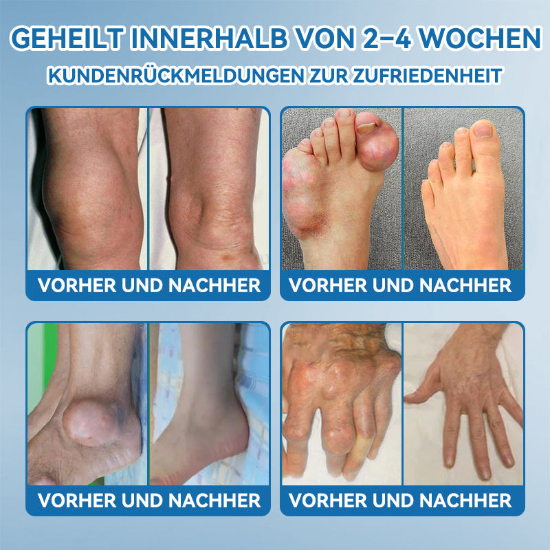 𝖯𝗂𝖼𝗱𝗼® 🍀 BPC-157 Gelenkheilcreme Behandelt Arthritis, Neuropathie, Rheuma, Sportverletzungen & mehr👨‍🔬