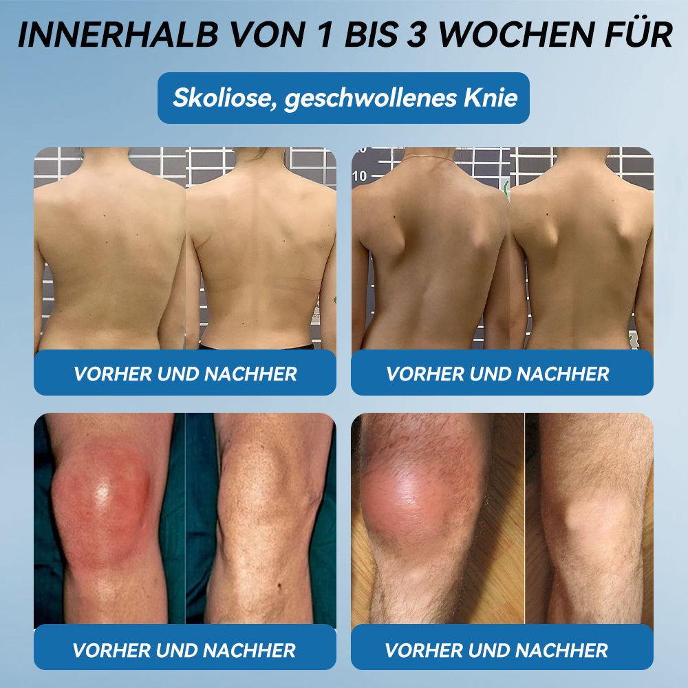 𝖯𝗂𝖼𝗱𝗼® 🍀 BPC-157 Gelenkheilcreme Behandelt Arthritis, Neuropathie, Rheuma, Sportverletzungen & mehr👨‍🔬