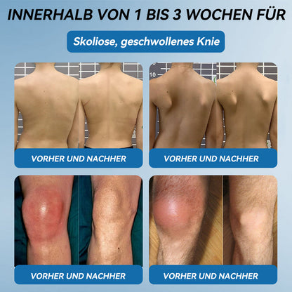 𝖯𝗂𝖼𝗱𝗼® 🍀 BPC-157 Gelenkheilcreme Behandelt Arthritis, Neuropathie, Rheuma, Sportverletzungen & mehr👨‍🔬